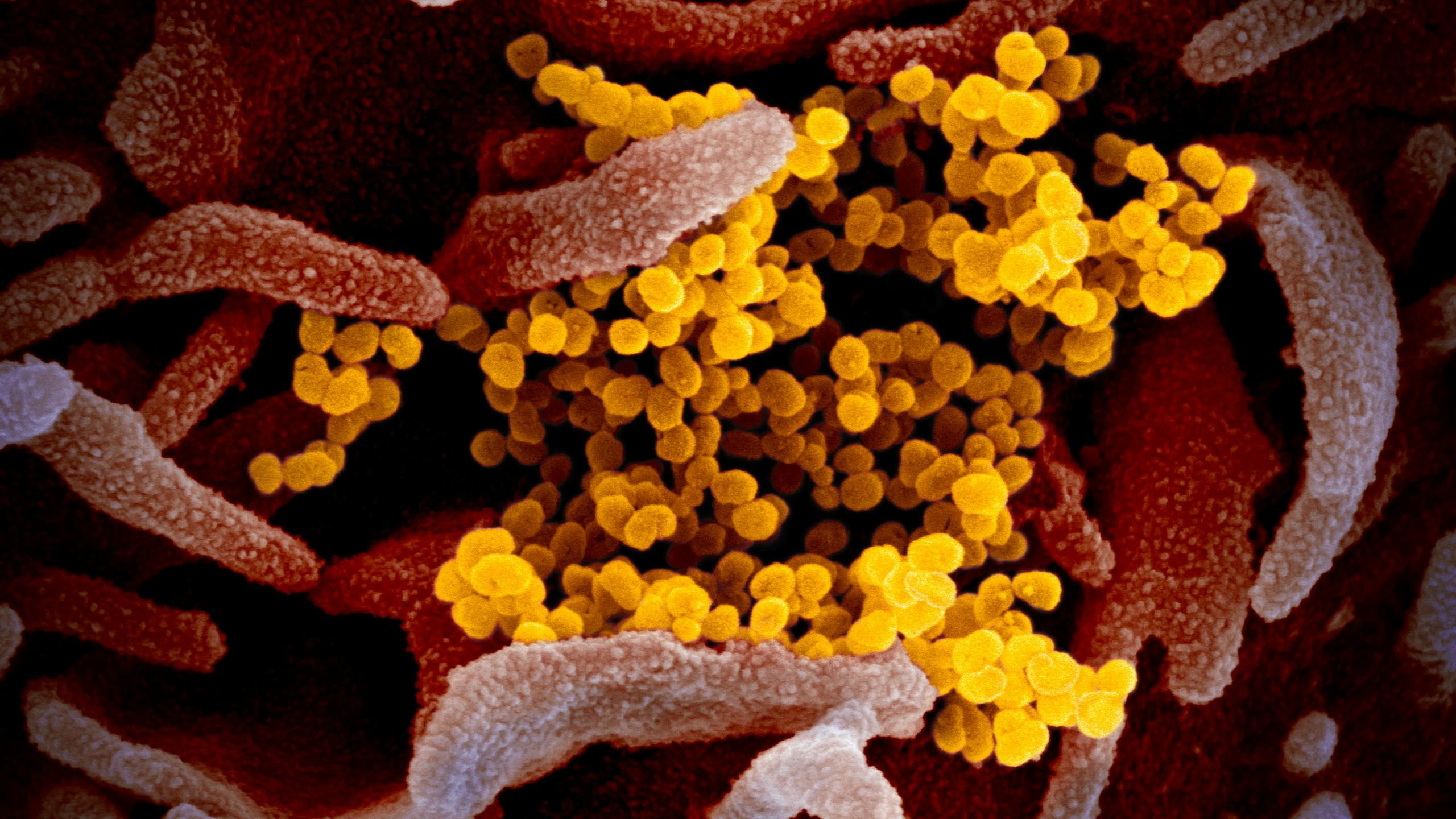 Eine Zotenartige Struktur mit orange Kugeln. Es ist das äußere einer Zelle und die Kugeln das Corona Virus.